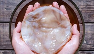 Tea fungus for the treatment of fungus in the foot