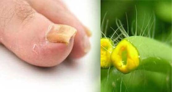 Celandine Herb for toenail fungus