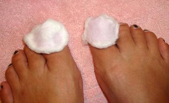compress toenail fungus treatment