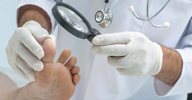 The doctor will prescribe medication for toenail fungus after diagnosing the disease