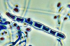 nail fungus pathogens under the microscope