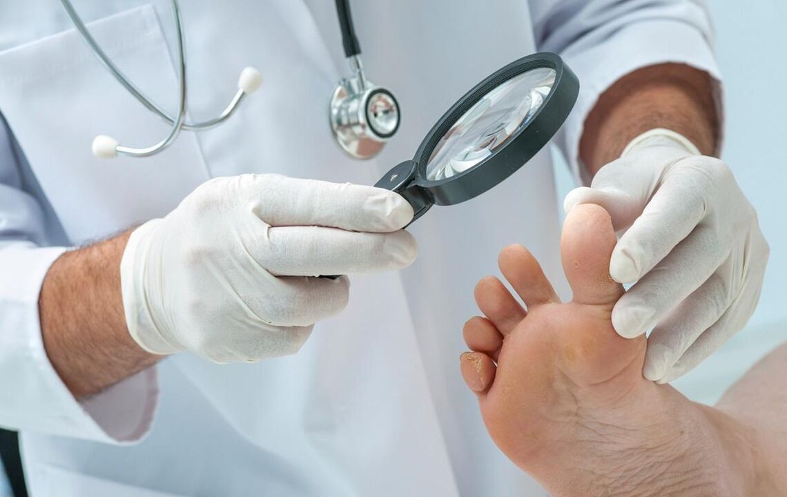 the doctor checks the nail for fungus